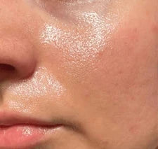 Before using PoreLab skincare routine